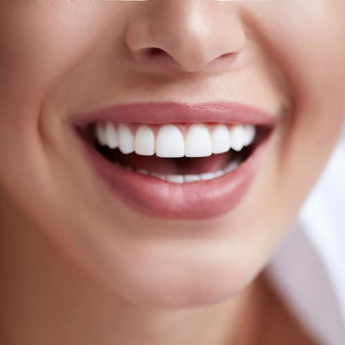 Teeth Whitening Family Dental Centre Guelph
