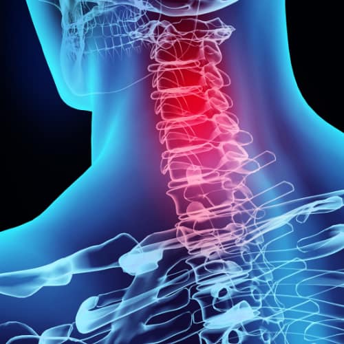 Jaw Causing Back and Neck Pain