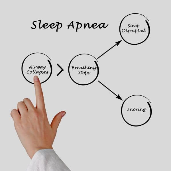 Stress Anxiety Sleep Issues Sleep Apnea